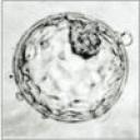 blastocyst.jpg