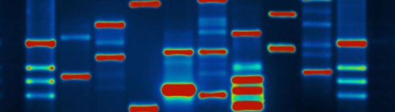 dna