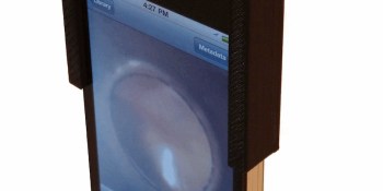Cool medical tech: Diagnose ear infections with a smartphone