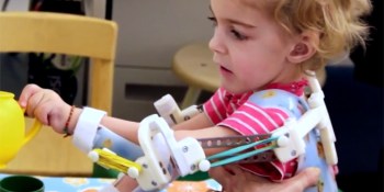 3D-printed exoskeleton gives a little girl use of her arms (video)