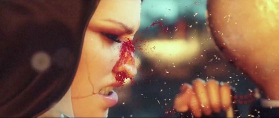 Broken nose