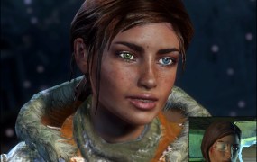Ellie's right eye