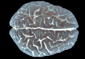 A human brain at work