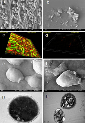 Closeup of IBM's nanomeds in action