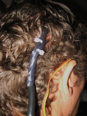The data port on the back of Jens Naumann's head.