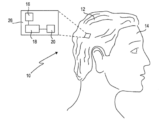 smartwig