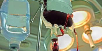 PayPal is botching its much-needed blood transfusion