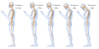 Surgeon develops an image of how texting warps your spine. We have a quick solution