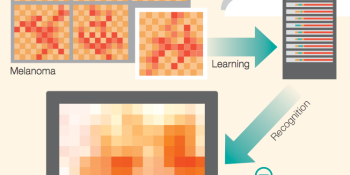 Skin cancer meets its worst nightmare: IBM