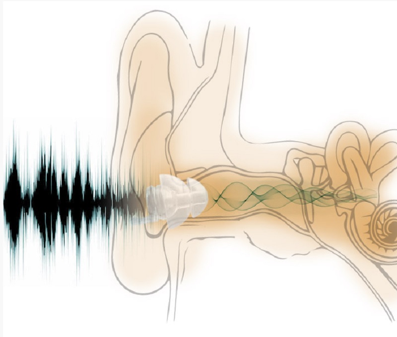 EarDial reduces noise and still lets you hear sounds.