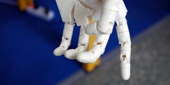 AI is transforming medical diagnosis, prosthetics, and vision aids