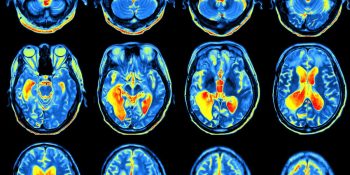 AI isn’t just taking jobs, it’s saving lives