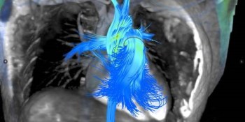 AI Weekly: AI is hunting the world’s deadliest killer