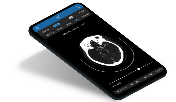Viz.ai