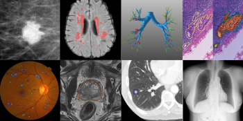 AI and the transformation of the medical world