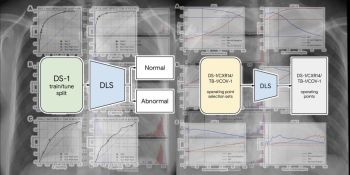 Google’s new deep learning system can give a boost to radiologists