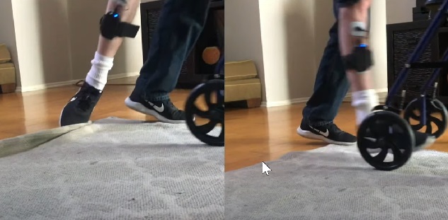 Fighting foot drop.
