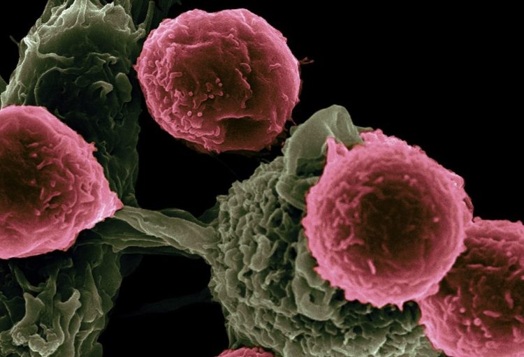 This scanning electron microscope image shows dendritic cells, pseudo-colored in green, interacting with T cells, pseudo-colored in pink.